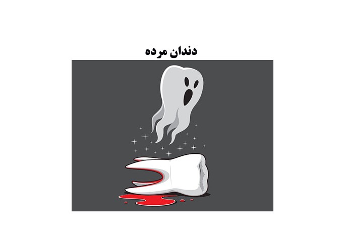 تشخیص و درمان دندان مرده